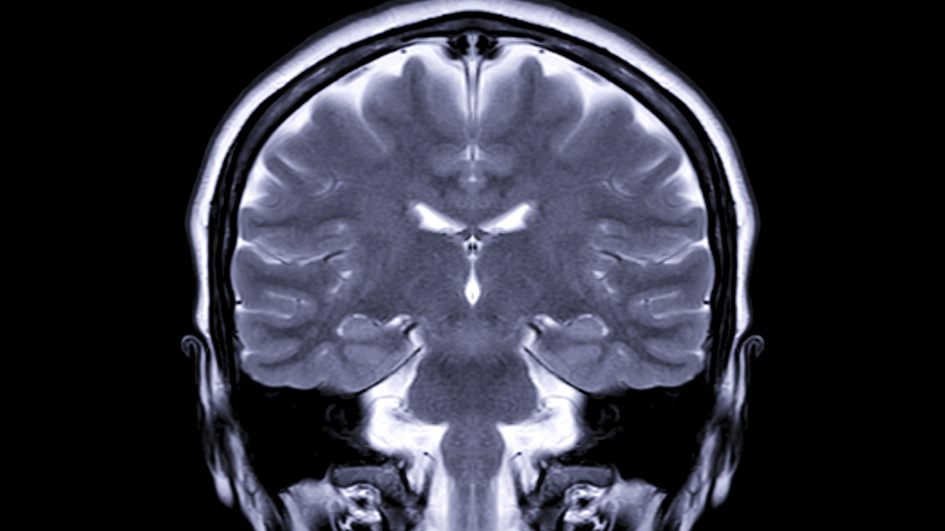 GitHub - Adityathere/Brain-Tumor-Detection-Using-CNN: Brain Tumor ...